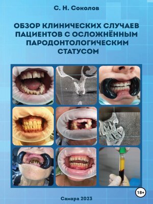 cover image of Обзор клинических случаев пациентов с осложнённым пародонтологическим статусом
